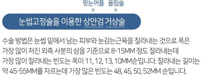 눈썹고정술을 이용한 상안검 거상술